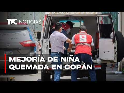 Niña sobreviviente de explosión en Copán muestra mejoría tras sus primeras cirugías