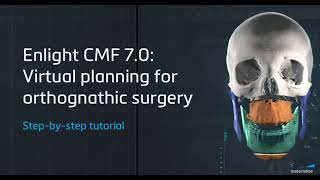 Enlight CMF 7.0: Virtual Planning for Orthognathic Surgery