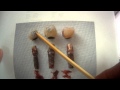 Implant Infection Removal #5