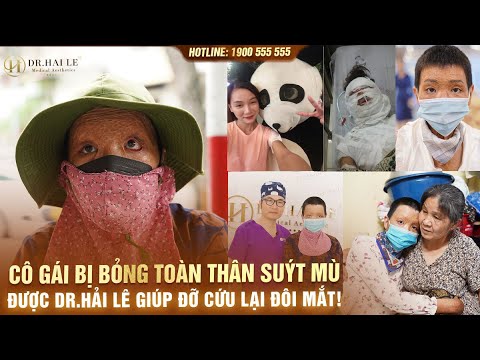 Cô Gái bị Bỏng Toàn Thân Suýt Mù Được Dr.Hải Lê Giúp Đỡ Cứu Lại Đôi Mắt