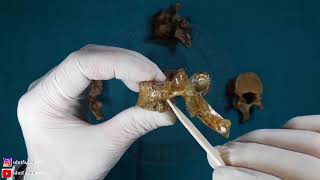 Columna Vertebralis'in Bütünü ve Vertebra'lar