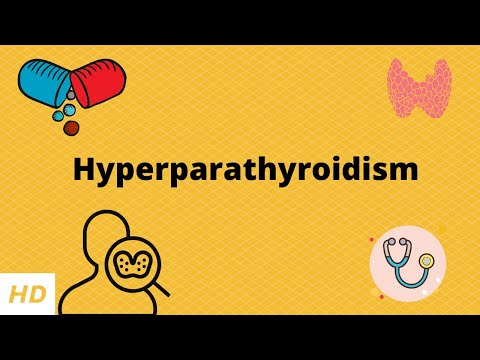 Hyperparathyroidism, Causes, Signs and Symptoms, Diagnosis and Treatment,