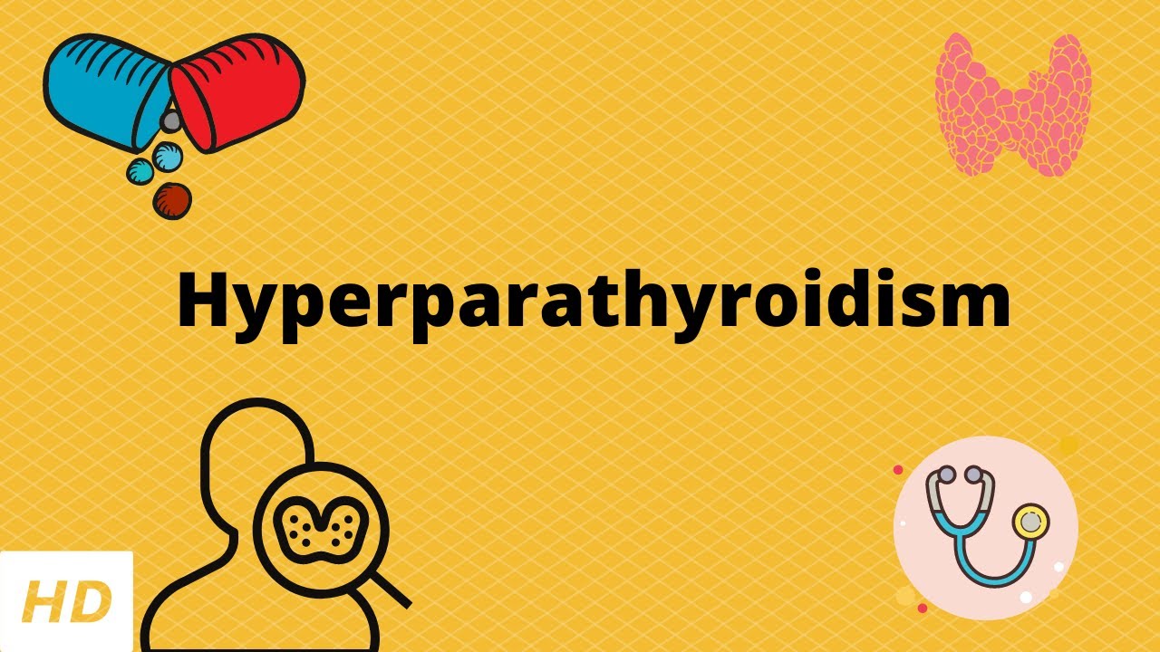 Hyperparathyroidism, Causes, Signs and Symptoms, Diagnosis and Treatment,