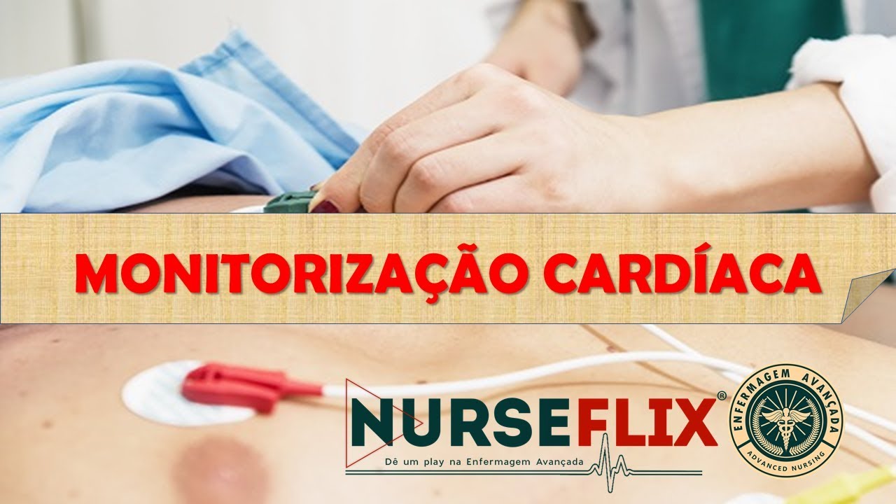 NURSEFLIX | Monitorização Cardíaca - ECG.