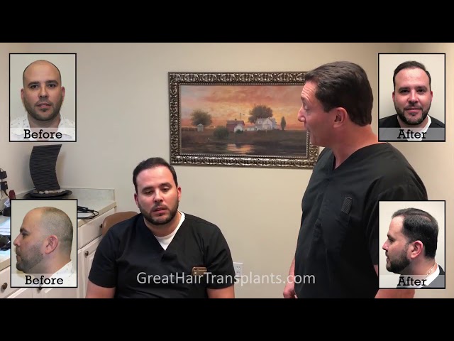 Dr. Brett Bolton Patient Adrien MaxHarvest&trade; Plus - 1 Year Follow Up
