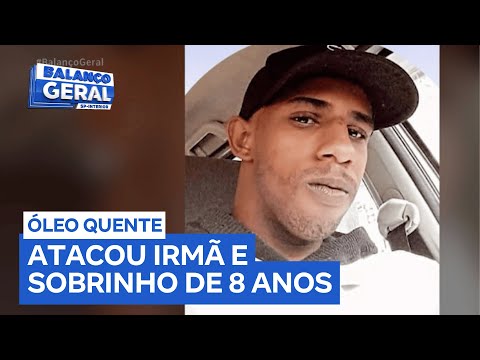 Man throws hot oil on his sister and 8-year-old nephew in Sertãozinho (SP)