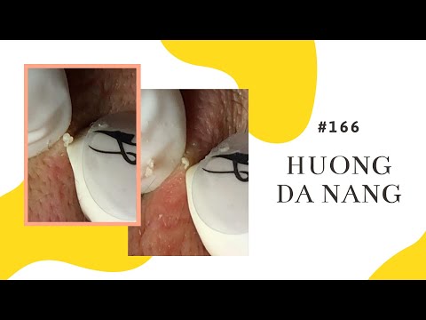 #166 | Huong Da Nang