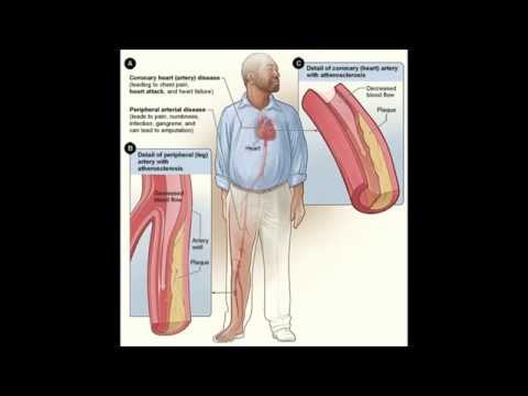 Biostats problem based learning- Smoking and Heart rate