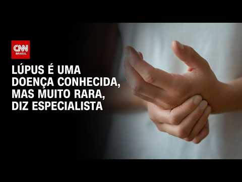 Lúpus é doença conhecida, mas bastante rara, conta especialista à Kalil | Sinais Vitais
