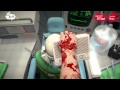 What a Load of Bull Trophy / Achievement (Surgeon ...