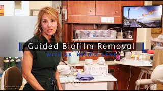 Guided Biofilm Removal