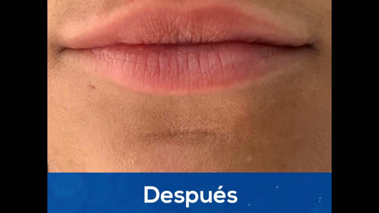 Juan Enrique Pérez Enríquez-172