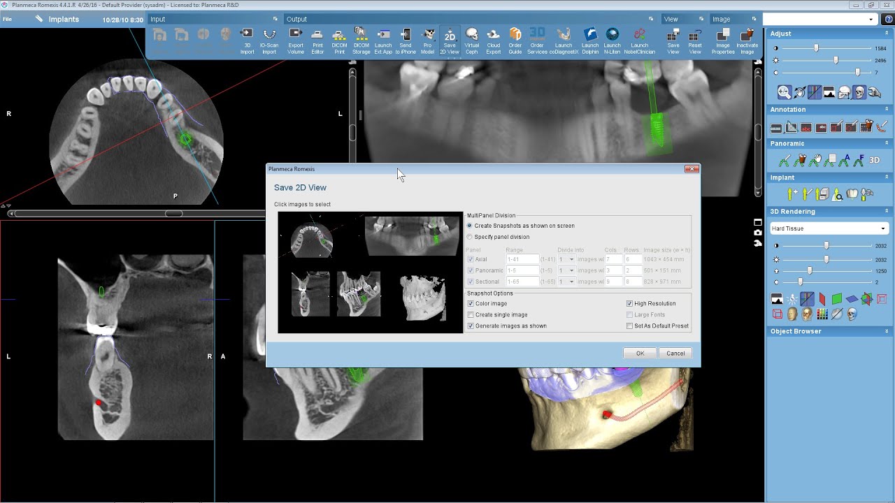 Saving 2D views in 3D module