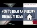 How to Fix an Ingrown Toenail at Home | Tutorial