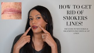 How To Get Rid of Smoker