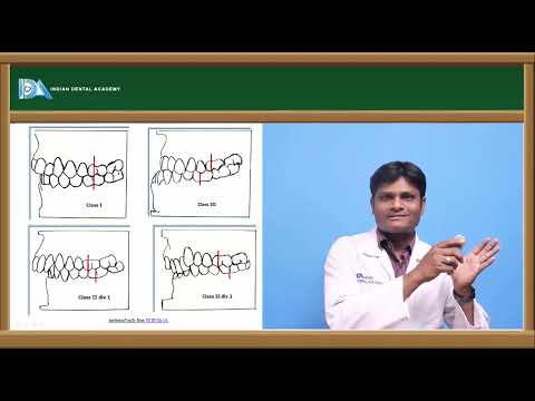 CLASSIFICATION OF MALOCCLUSION | Orthodontics | #NEET#MDS#BDS#NBDE#ORE#DDS