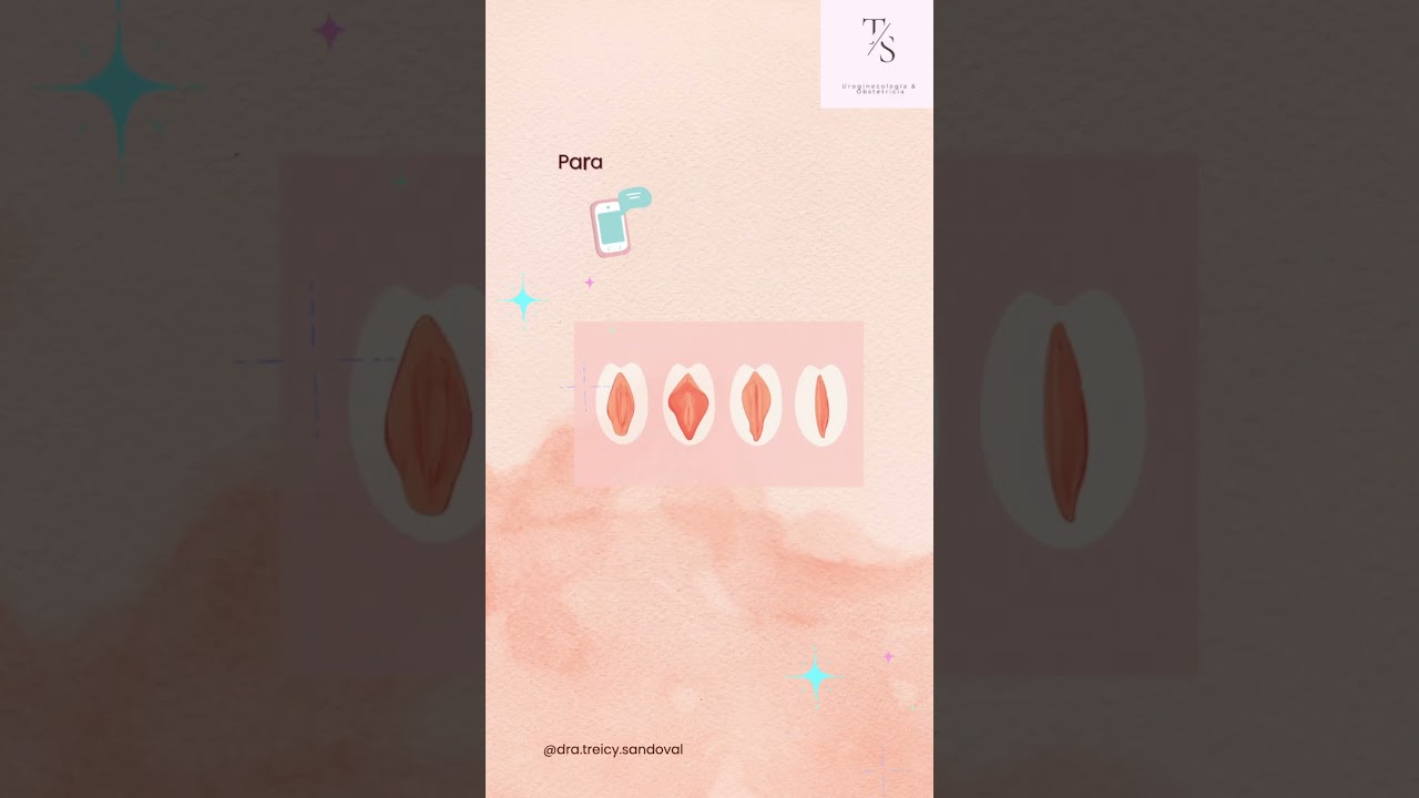 Treicy Sandoval Mariscal-20