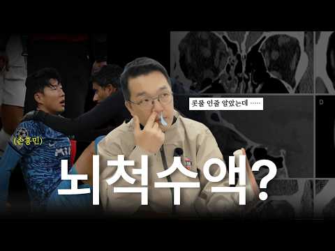 국가대표 주치의 — 축구선수 부상 TOP3