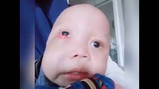 Download lagu Raffa Tumor Gusi (Part 1) mp3 Download lagu Raffa Tumor Gusi (Part 1) mp3