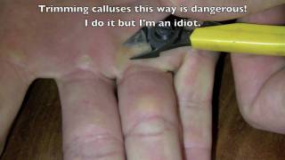Calluses and bodybuilding