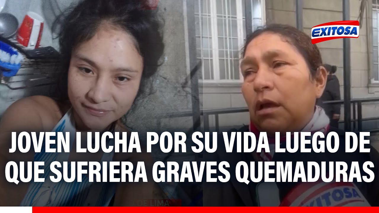 🔴🔵 Joven lucha por sobrevivir luego sufrir graves quemaduras: Familiares exigen justicia