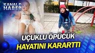 Uçuklu Öpücük 6 Yaşındaki Atlas'ın Hayatını Kararttı! DİKKAT: Severken Virüs Bul