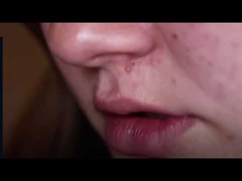 Vorwürfe gegen russische Truppen 😢 16-Jährige Dascha schildert die Vergewaltigung durch Soldaten 😭