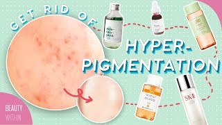 Best Ways to Reduce Hyperpigmentation &amp; Dark Spots: Ingredients, Products &amp; Natural Remedies