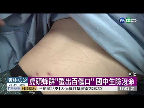 玩棒球驚動虎頭蜂 3國中生遭螫傷!