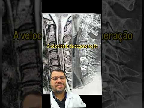 Marco Aurélio Severo Da Silva Versiani-99