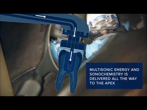 Forbes Endodontics GentleWave