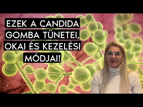 🤔Minden amit tudni kell a candida gombáról - hillvital.hu