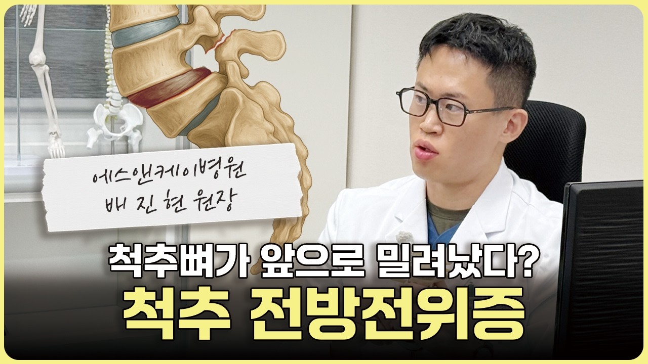 척추뼈가 밀려났다? 허리 통증 원인 ‘척추 전방전위증’ #척추전방전위증 #허리통증 #척추 #대전척추병원
