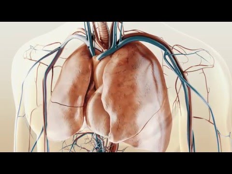 Idiopathische Lungenfibrose (Deutsch)