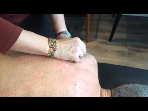 IMS for Shoulder and Rotator Cuff Tightness and Pain