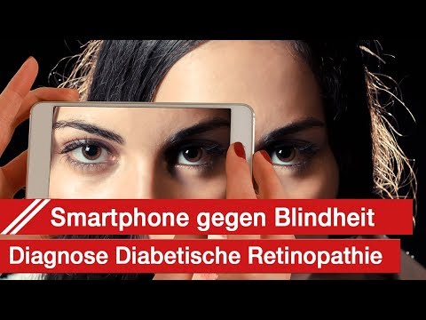 Sconces bei Diabetes Die Behandlung von Diabetes mit Walnüssen