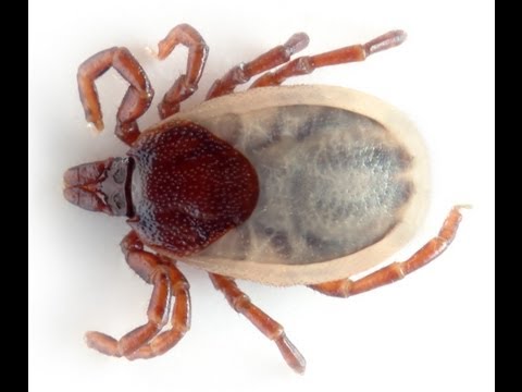 Displasia dellanca negli adulti Malattia articolare pelvica