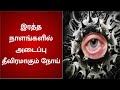 இரத்தநாளங்களில் அடைப்பு ஏற்பட்டு தீ�