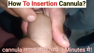 How to insert cannula?, cannula कैसे लगाएं?, cannula लगाने का सही तरीका, iv cannula procedures 