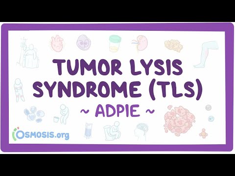 Tumor lysis syndrome (TLS): Nursing Process (ADPIE)