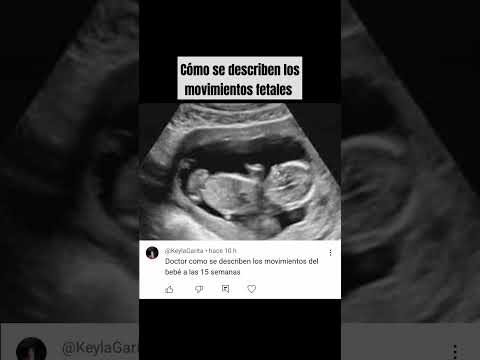 Fetal movement at 15 weeks #pregnancy