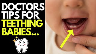 Doctor explains key things you need to know about BABY TEETHING | Symptoms & tips for managing it!