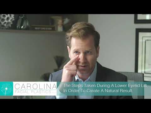 How To Achieve Natural and Long-Lasting Results With A Lower Eyelid Lift How To Achieve Natural and Long-Lasting Results With A Lower Eyelid Lift