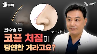 [무.물] 코끝 처짐이 당연한 것이라고요❓  #김종구 #코수술 #코재수술