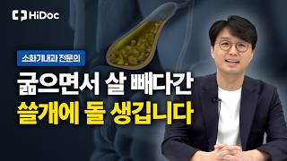 급격한 다이어트 시 담석증 예방하는 UDCA 복용법과 올바른 식습관 l 소화기내과 조성철 원장