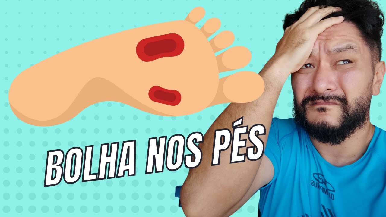 Bolha nos pés, o que fazer?