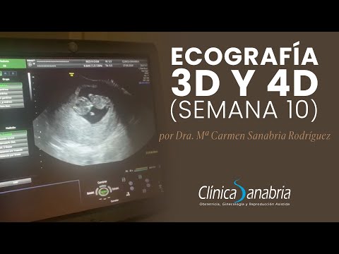 Clínica Sanabria || Ecografía 3D y 4D (10 semanas)