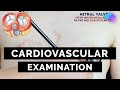 Cardiovascular Examination OSCE Guide UKMLA CPSA PLAB 2