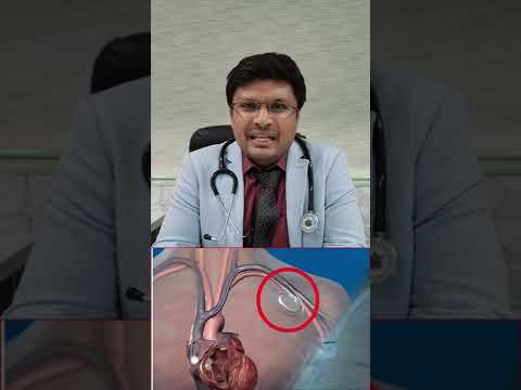 When does a pacemaker need to be replaced after implantation? How long does a pacemaker last?