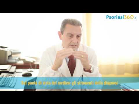 Schema di cura di psoriasi imunofany Cura arsenicale di psoriasi